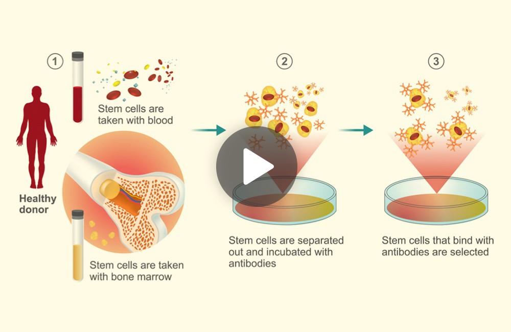 How cord blood banking works